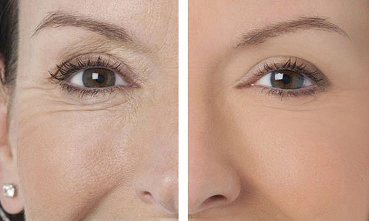 кожа вокруг глаз до 50 лет